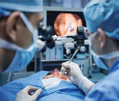 Endoscopic Nose and Sinus Surgery