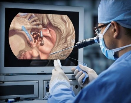 Endoscopic Skull Base Surgery